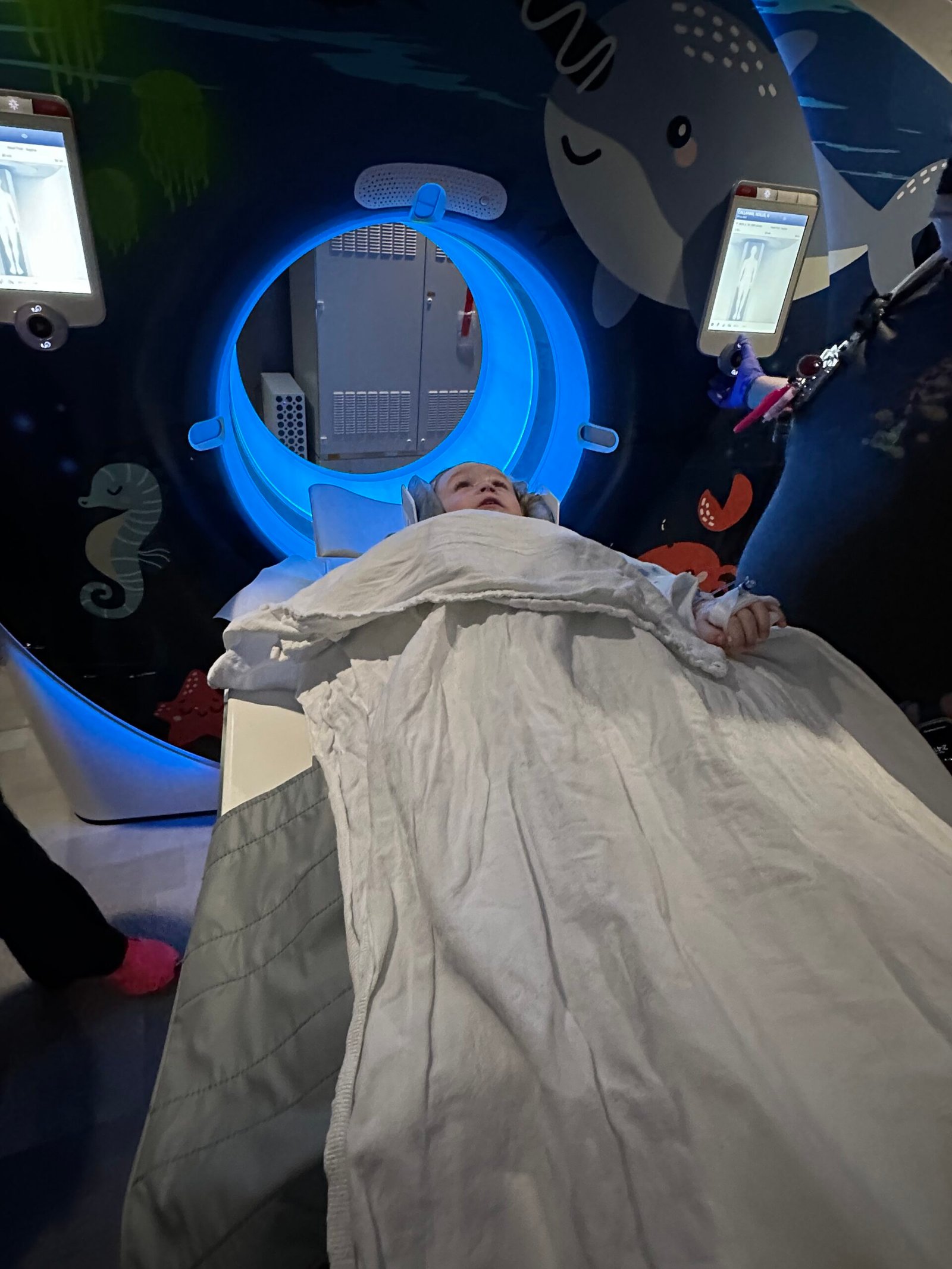 Brain CT_Our Experience with Incomplete Kawasaki Disease in a Toddler
