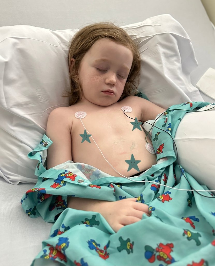 Hollis Post EKG_Our Experience with Incomplete Kawasaki Disease in a Toddler
