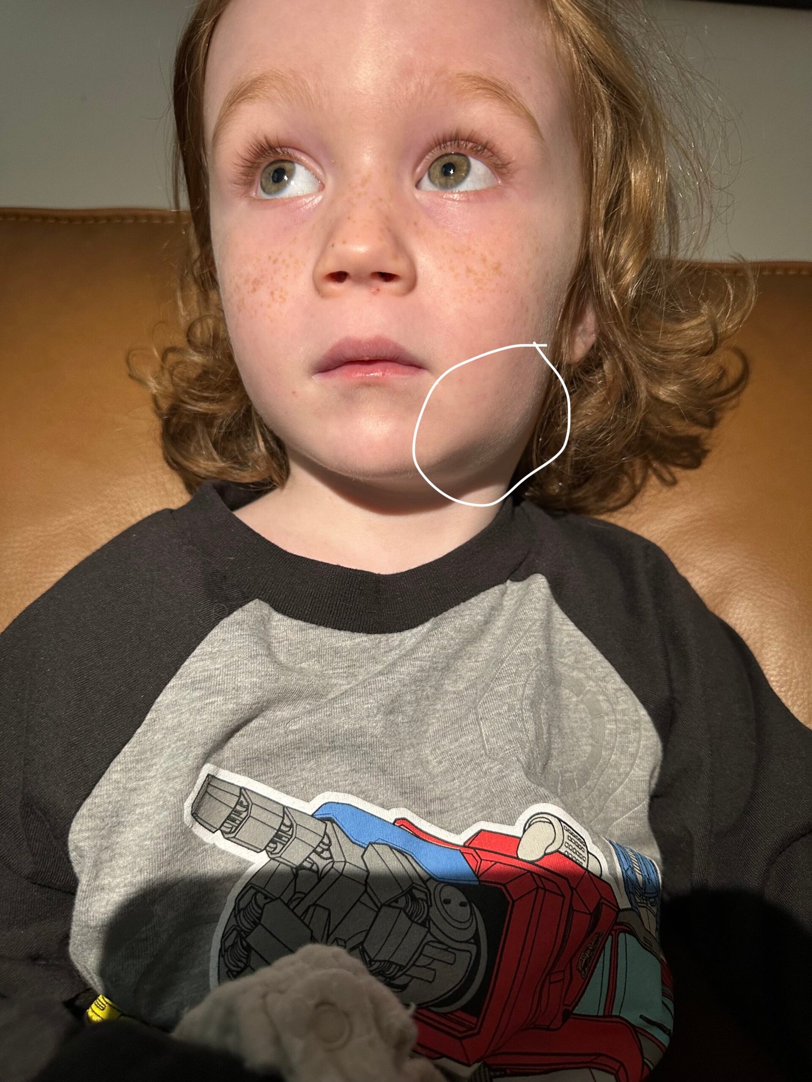 Hollis Swollen lymph nodesHollis and Hunter SnugglingPediatric Visit_Our Experience with Incomplete Kawasaki Disease in a Toddler